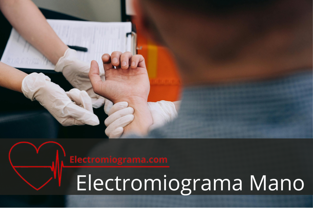 Electromiografía Mano